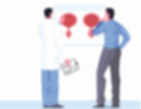Most Common Prostate Cancer