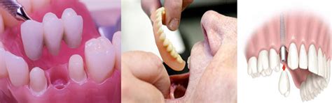 MDS Programme (Masters of Dental Surgery)