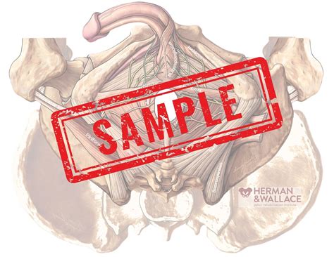 Herman & Wallace Pelvic Rehabilitation Continuing Education - Pelvic ...