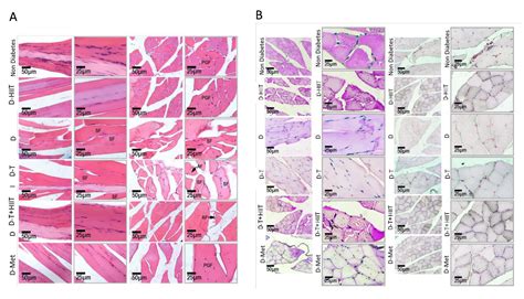 The Combined Effect of High-Intensity Interval Training and Time ...