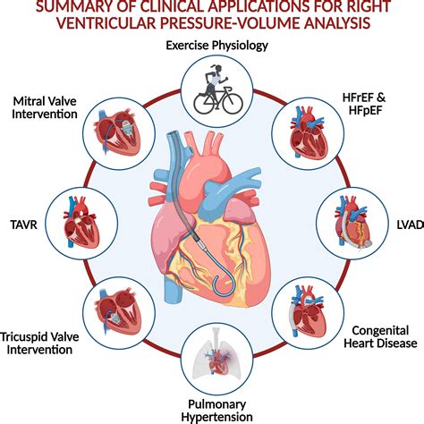 Invasive Right Ventricular Pressure-Volume Analysis: Basic Principles ...