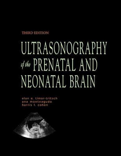 Buy Ultrasonography of the Prenatal & Neonatal Brain Book Online at Low ...