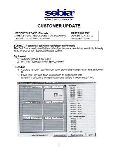 Image result for Sebia Reagent