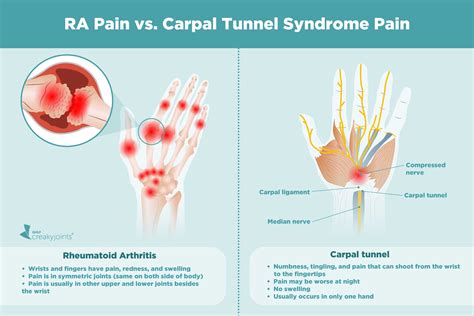 Causes of Rheumatoid Arthritis Pain Aside from Inflammation