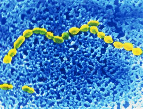 Image result for Enterococcus Faecalis Bacteria Cell Structure