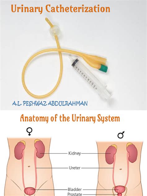 Image result for Catheterization Process