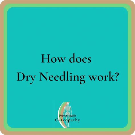 How does Dry Needling work? | Prime Health Osteopathy