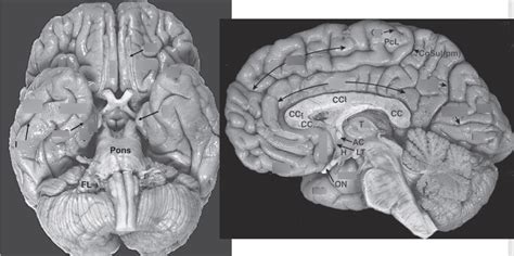 Rezultat imagine pentru Gyri