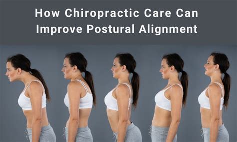 Image result for Chiropractic String Frame Alignment-Frame