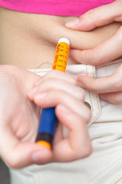 Image result for Subcutaneous Button Device