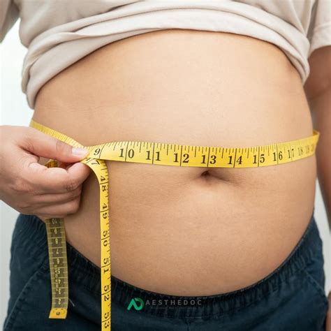 Fat Cellulite & Dissolving Injections Treatment Islamabad