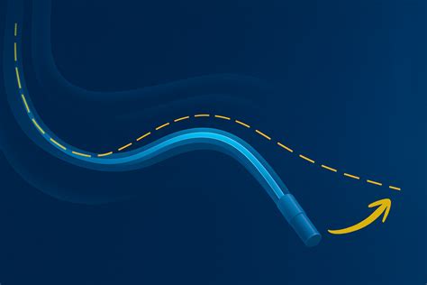 Image result for Closed Loop Control