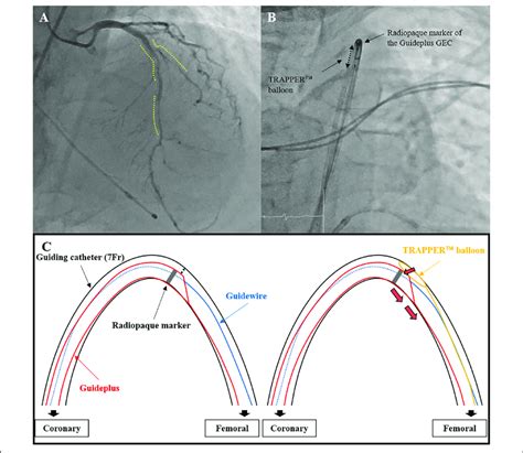 Image result for Guide Plus