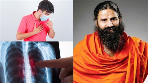 टीबी से निजात पाने के लिए स्वामी रामदेव ने बताए असरदार घरेलू उपाय ...