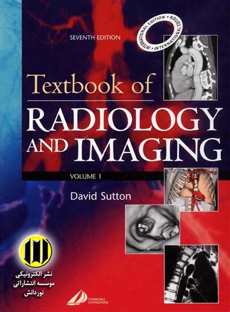 Textbook of Radiology And Imaging, Volume 1- E-Book eBook : Aggarwal ...