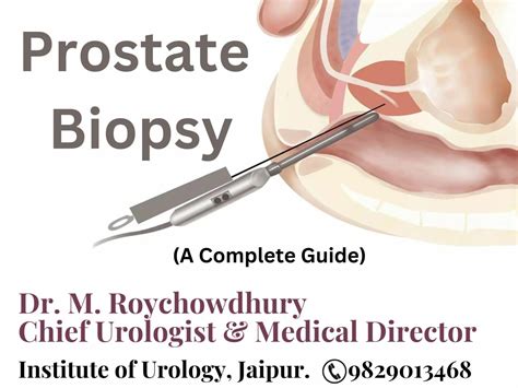 Prostate Biopsy - A Complete Guide