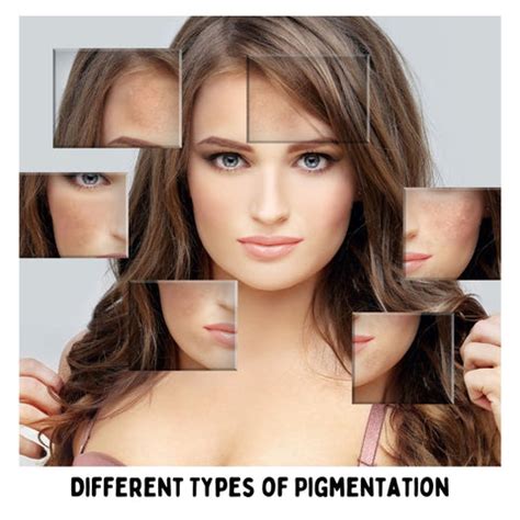 Strategies to Permanently Remove Facial Pigmentation | Clinikally