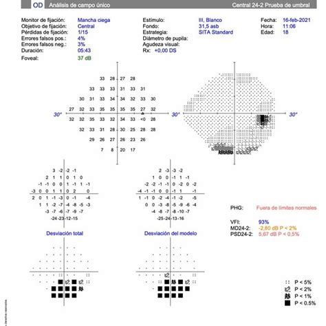 Computerized Algorithm 的图像结果