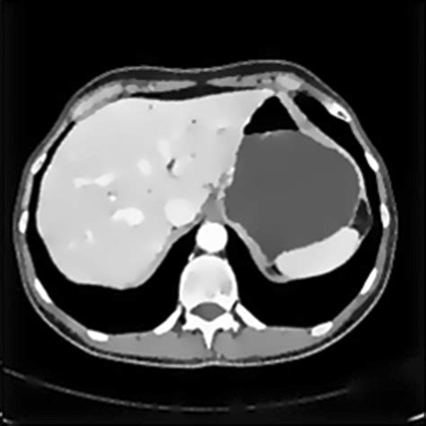 Image result for Anisotropic Filtering Explained