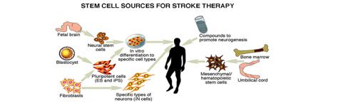 Stem Cell Therapy In India, Stem Cell Treatment Hospital Cost