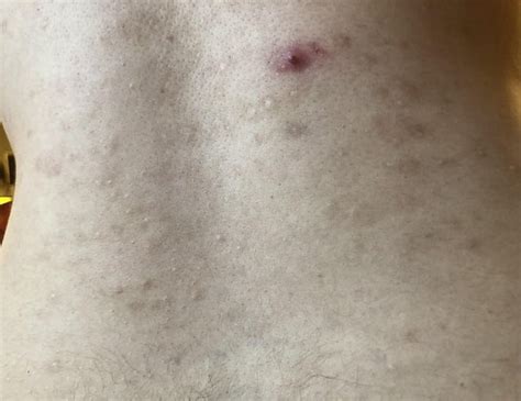 Image result for Popping Lower Back