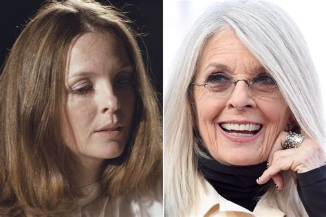 Celebrity Plastic Surgery Gone Wrong Before And After