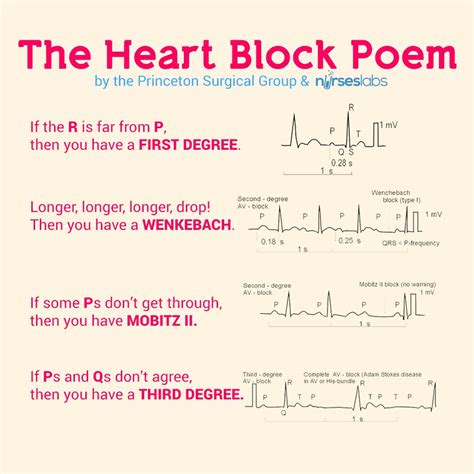 How to Identify Cardiac Arrhythmias (With Videos) | Poem, School and ...