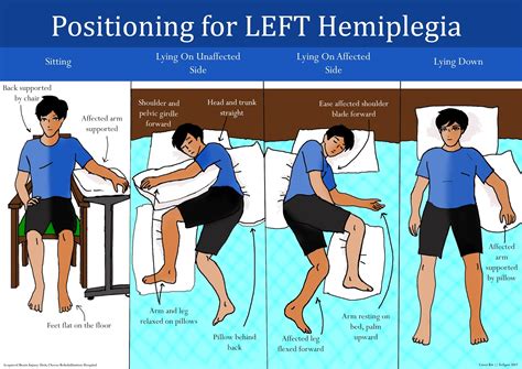 Carer Training Information: Positioning for Left Hemiplegia
