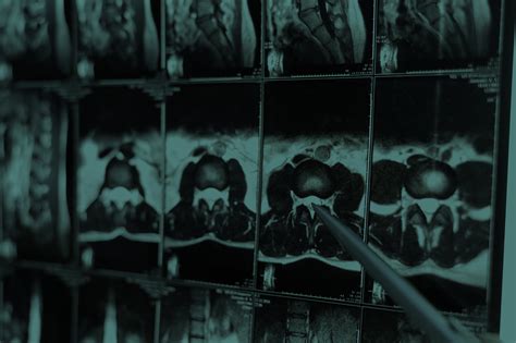 Image result for Spinal Tap Stumpy