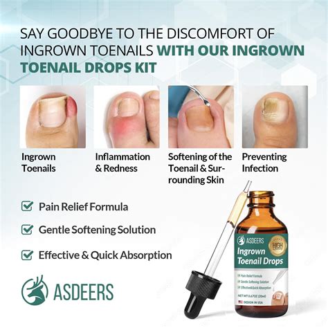 Asdeers Ingrown Toenail Treatment: Ingrown Toenail Removal India | Ubuy