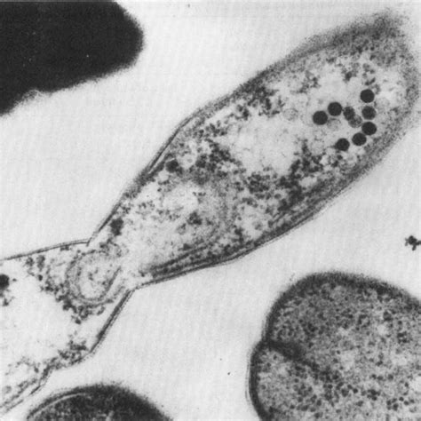 Image result for Most Dense Hexagonal Structure