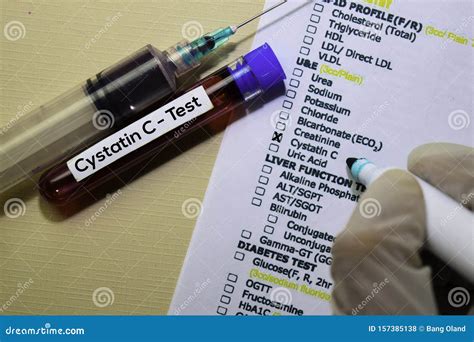 Cystatin C - Test with Blood Sample. Top View Isolated on Office Desk ...