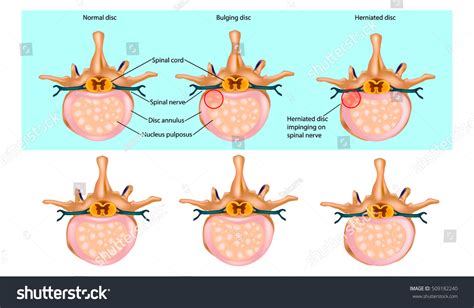 Disk Problem 的图像结果