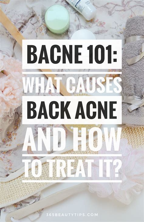 Bacne 101: What Causes Back Acne and How to Treat it | Back acne ...