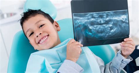 Understanding Dental X-Rays: Types, Purposes, and Cost | SmileWide