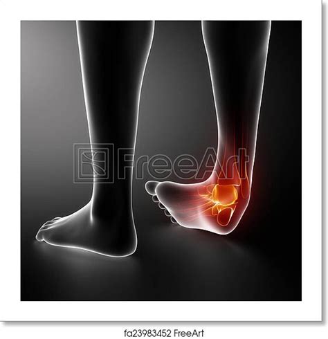 Free art print of Sprained ankle black x-ray | FreeArt | fa23983452