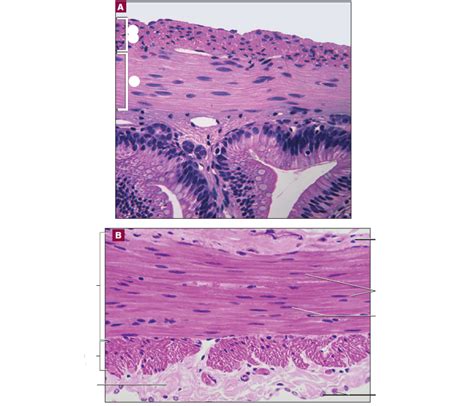 Histology of: Smooth Muscle Diagram | Quizlet