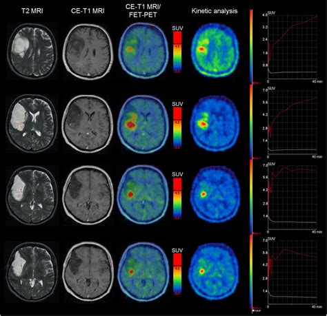 Does Covid Cause Cold Feet