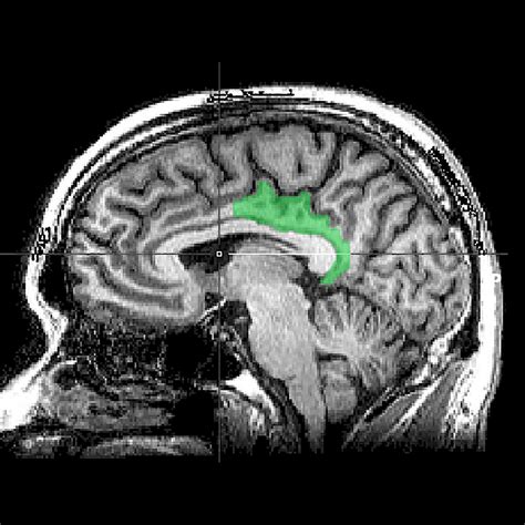 Image result for Cingulate cortex Anatomy