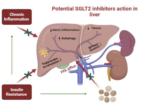 The Effects of SGLT2 Inhibitors in Patients with Metabolic Dysfunction ...