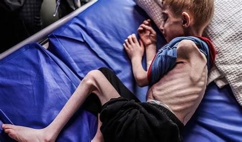 Videos of malnourished children show Gaza’s forced starvation crisis | Gaza | Al Jazeera