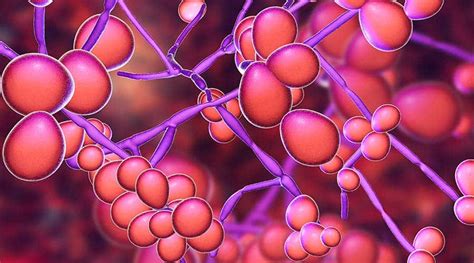 Candidiasis : कैंडीडायसिस के कारण, लक्षण, उपचार और घरेलू उपाय हैलो ...