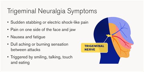Trigeminal neuralgia symptoms, treatment | Blog | Loyola Medicine