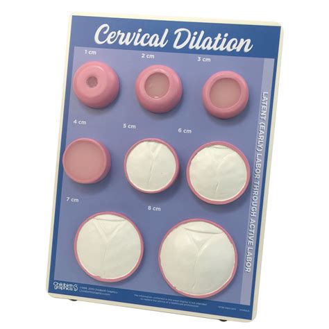 Cervical Effacement & Dilation Chart | Childbirth Graphics