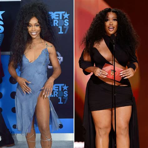 Did SZA Get Plastic Surgery? Photos of the Singer’s Before and After Transformation, Quotes