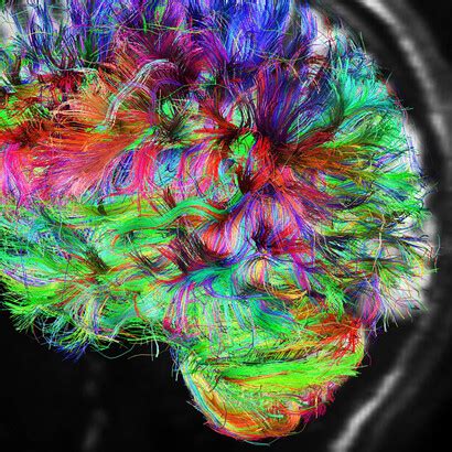 A scale-space approach to connectomes | Meer