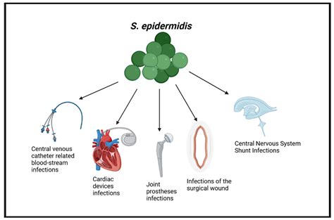 Difficult-to-Treat Pathogens: A Review on the Management of Multidrug ...