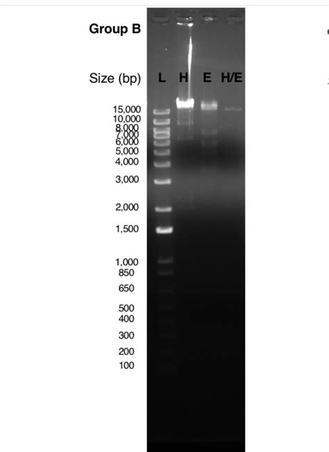 Restriction Map Explained 的图像结果