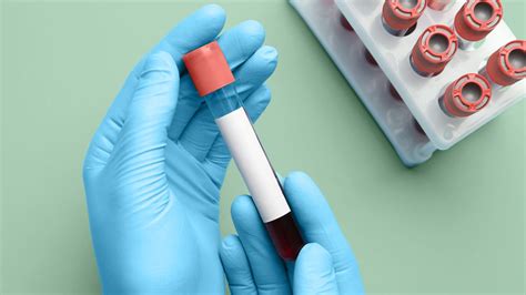 Stages of Atopic Dermatitis: What Do They Mean?