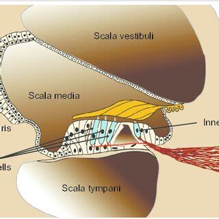 Image result for Modiolus Cochlea